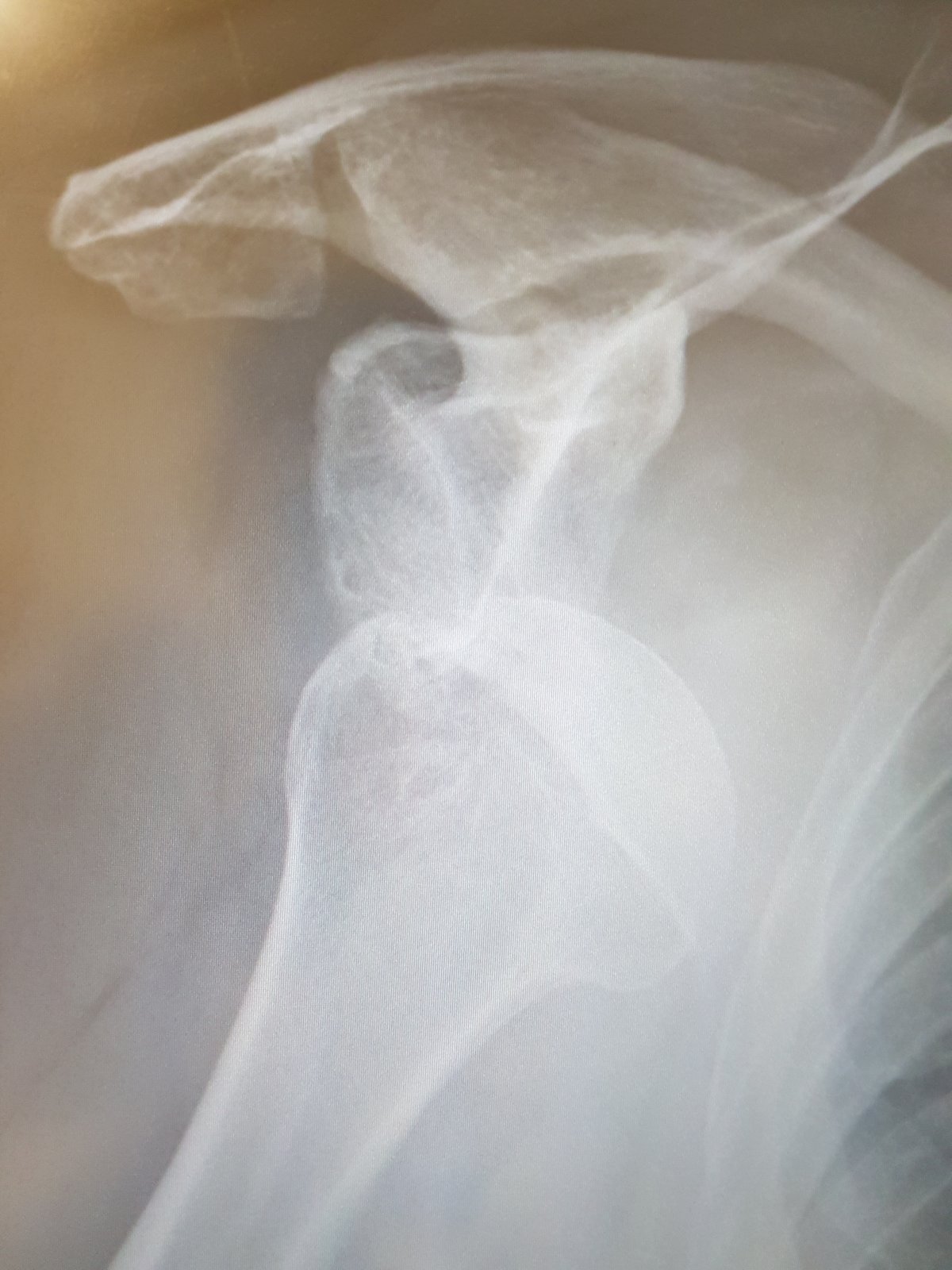 20180814_111740.jpg
