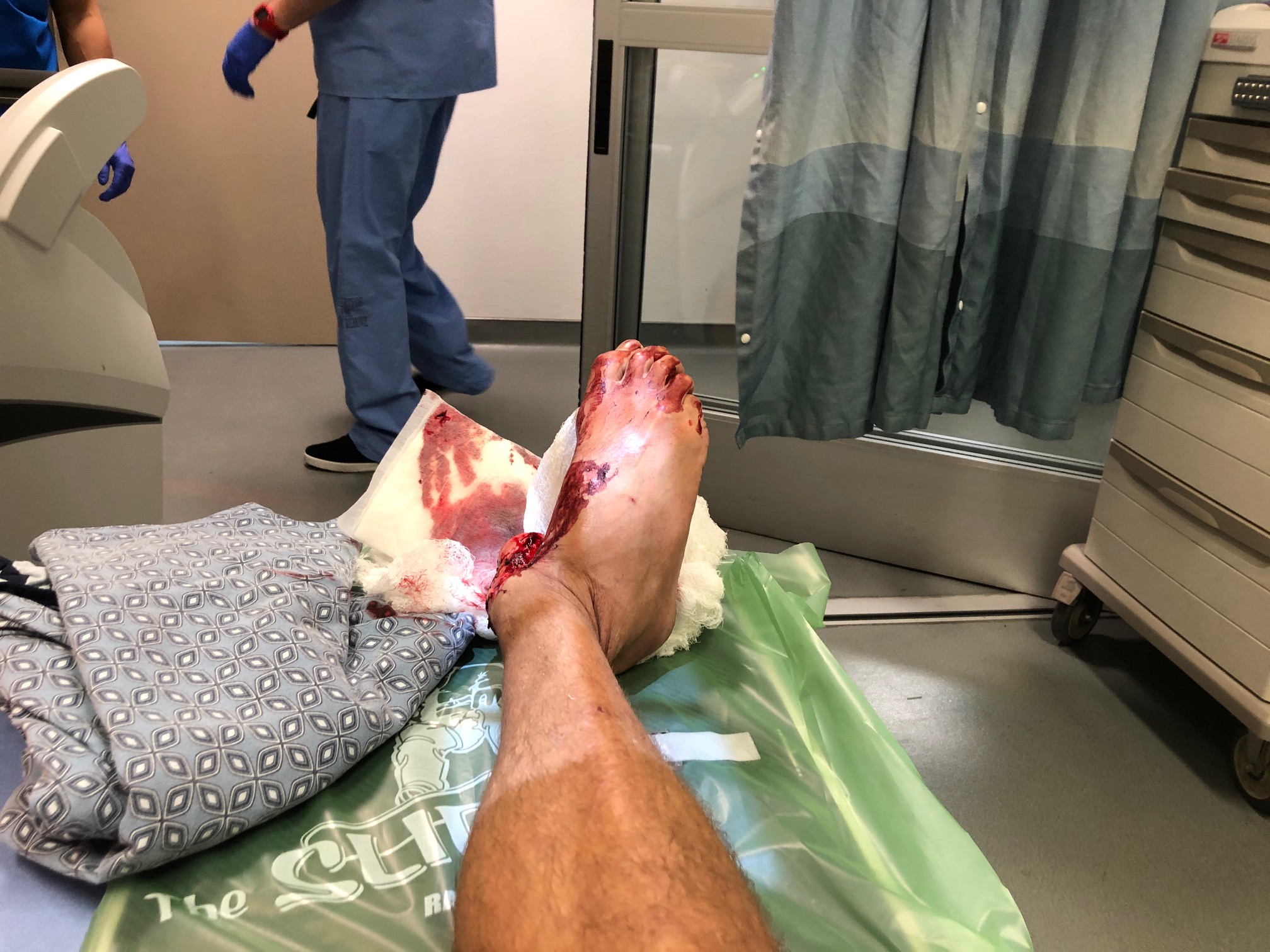Ankle - B (1).jpg