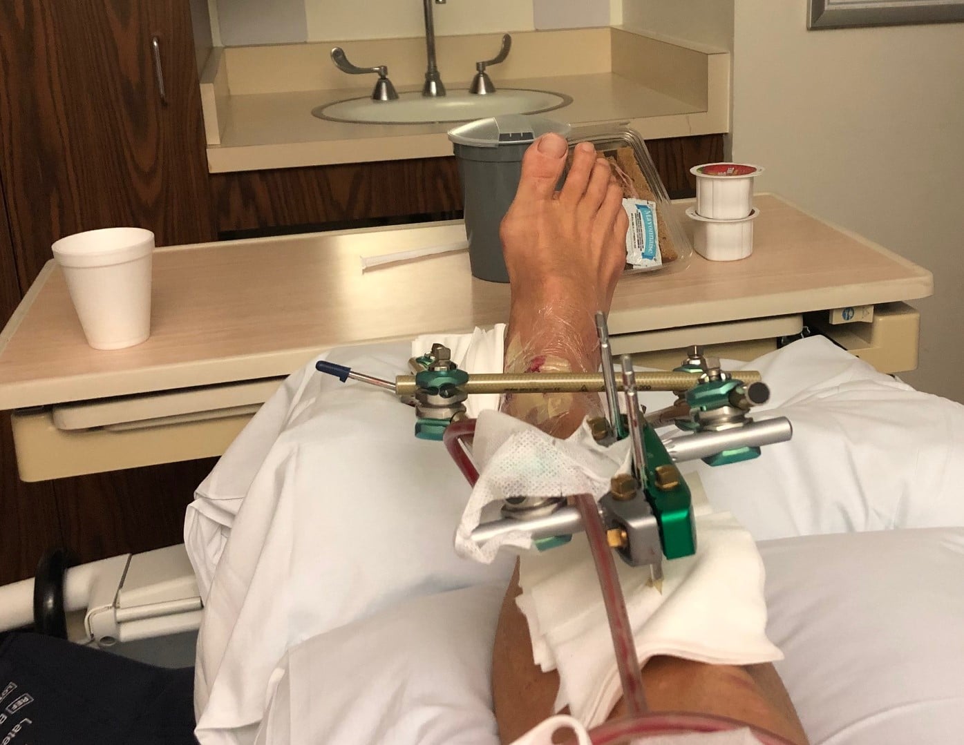 Ankle - Cc.jpg