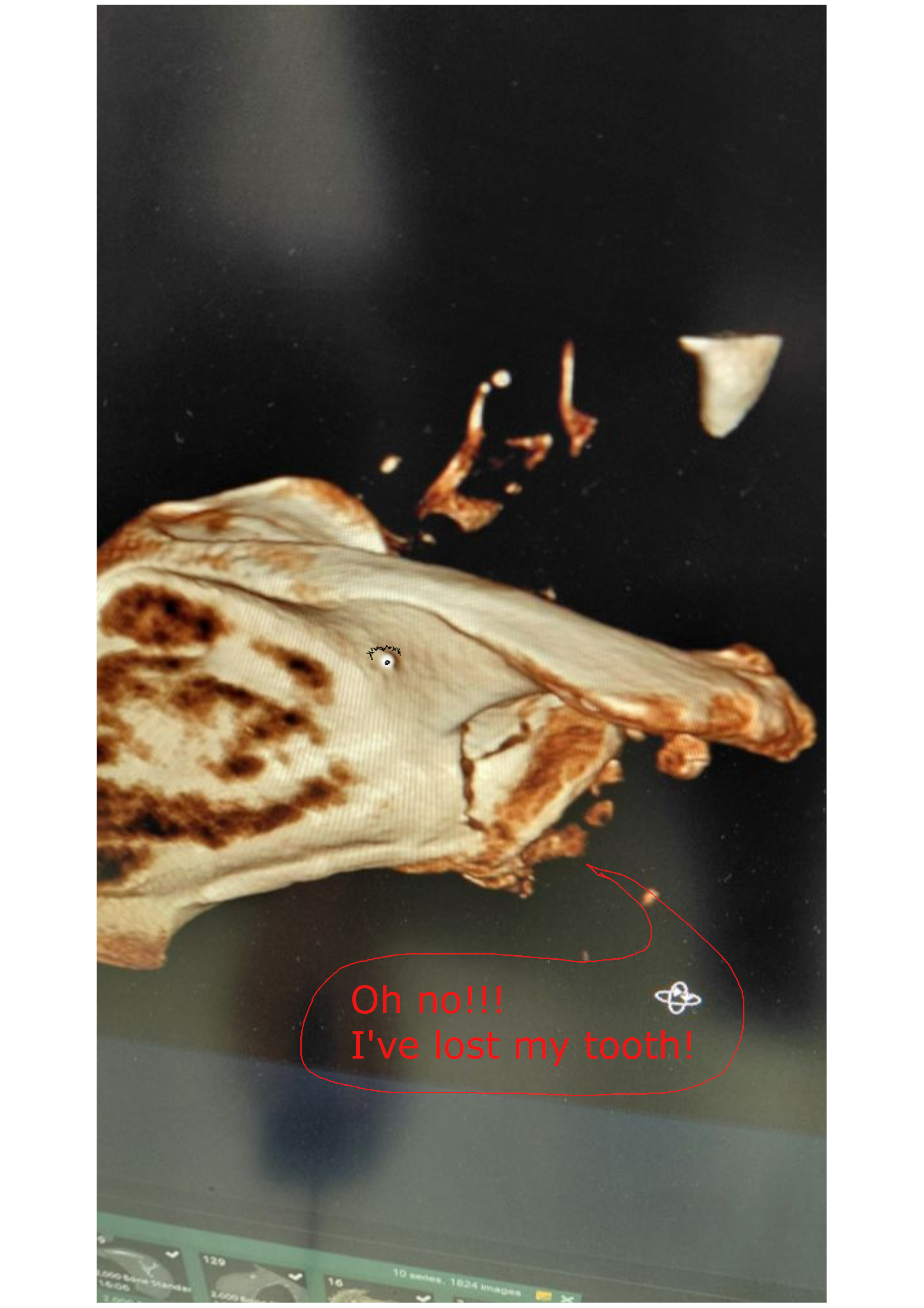 Boney.png