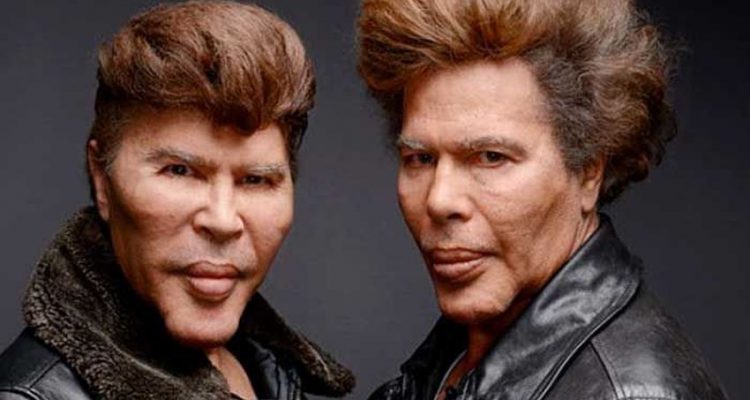 Celebrity-Plastic-Surgery-Disasters-750x400.jpg