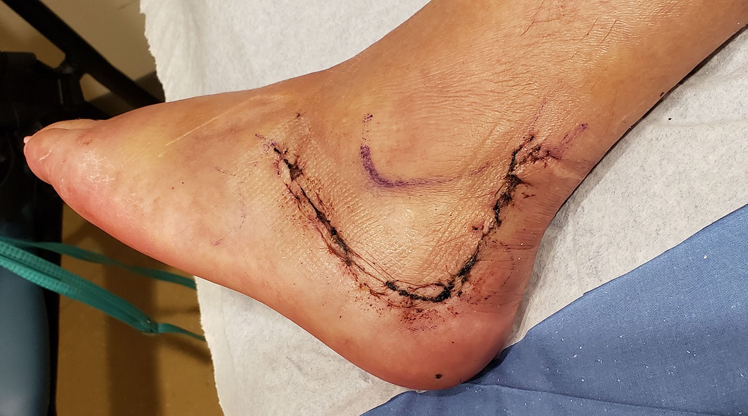 foot 1.jpg
