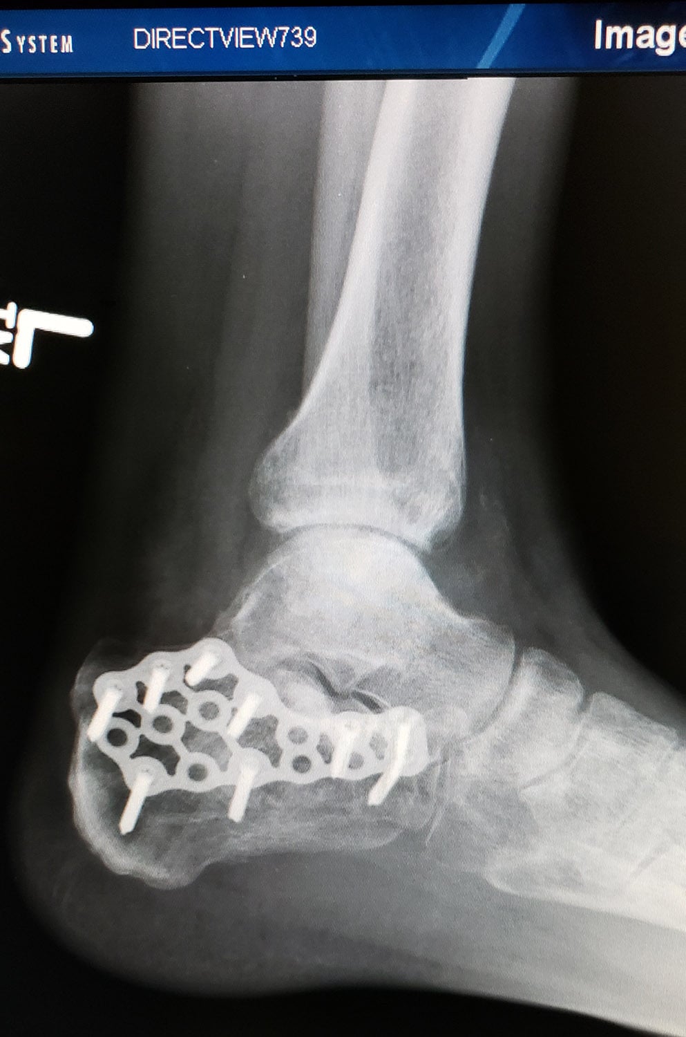 foot 2.jpg
