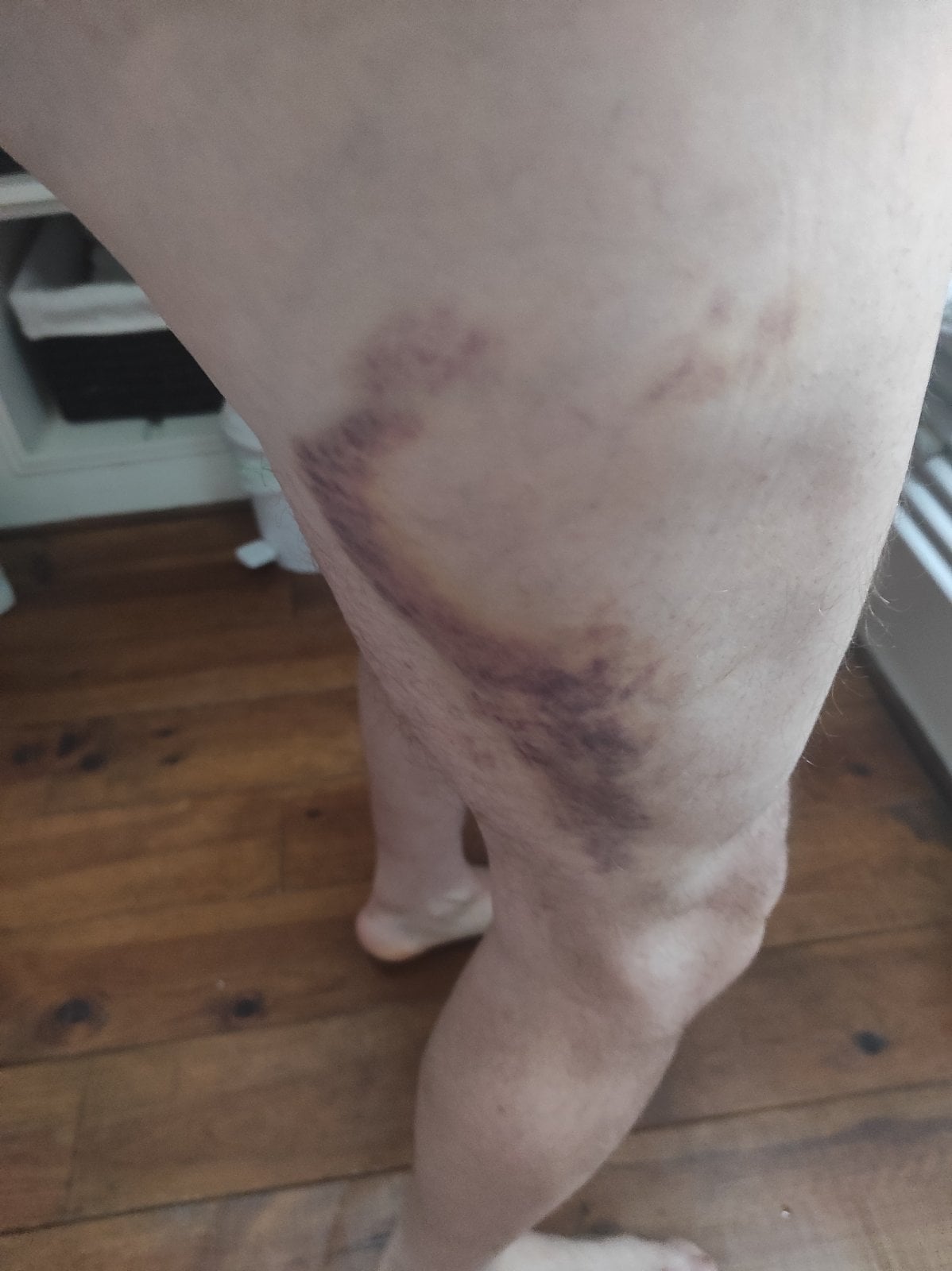 leg.jpg
