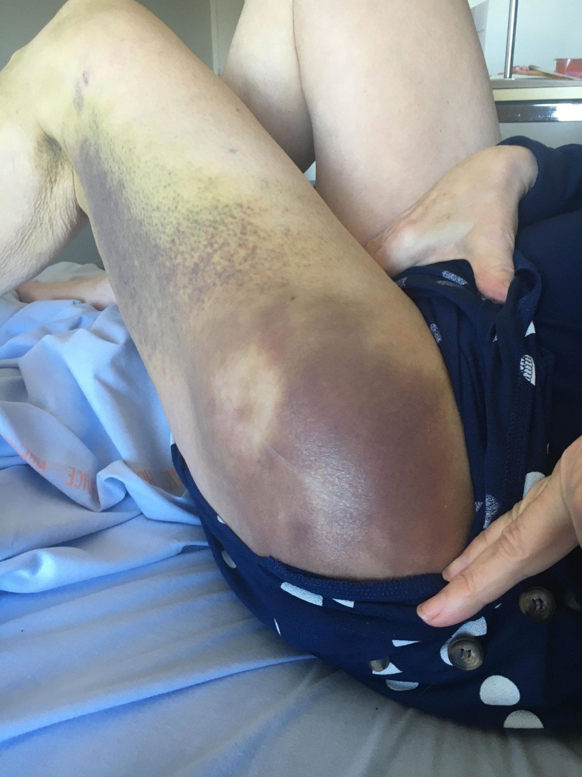 leg.jpg